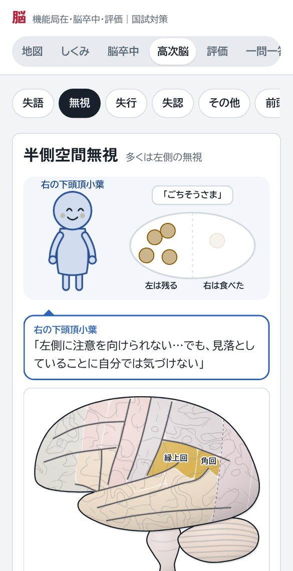 半側空間無視の画面。左側の食事を残す場面の絵と病巣