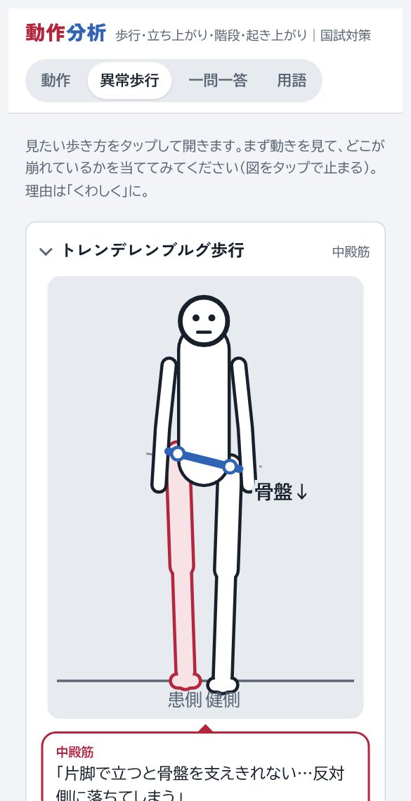 異常歩行の画面。トレンデレンブルグ歩行の図