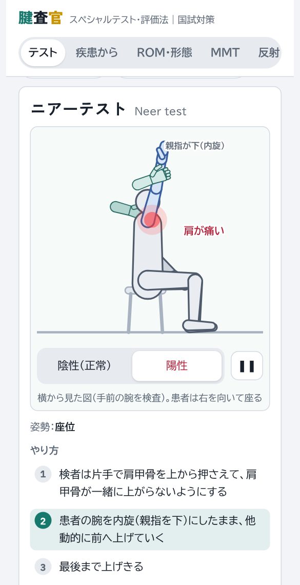 ニアーテストの画面。陽性で肩の前が痛む動き
